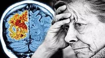一招教你老年“不痴呆”——新药LEQEMBI延缓阿尔茨海默效果持久！