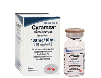 胃癌早中晚期症状表现